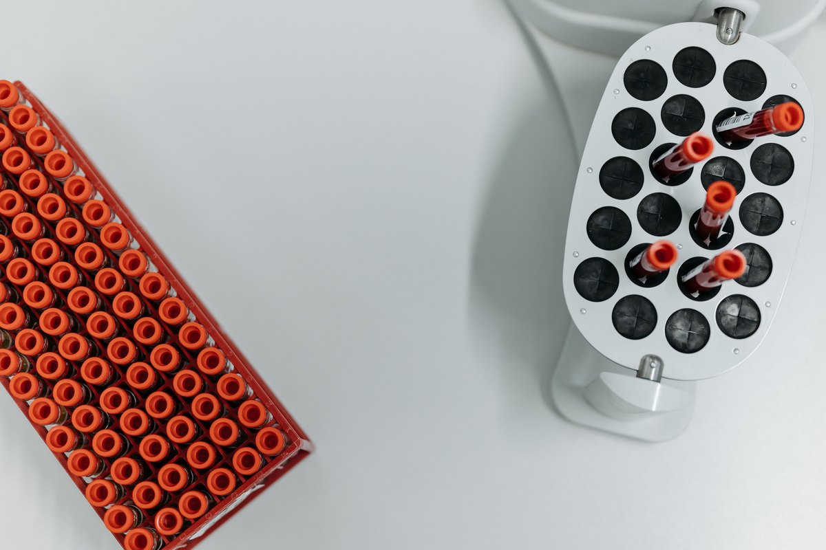 Orange-capped sample tubes beside an open laboratory centrifuge