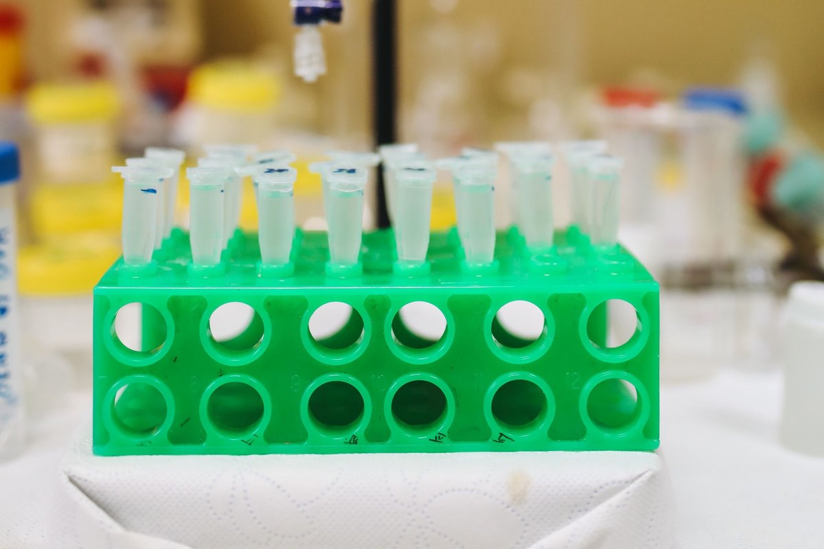 Clear sample tubes arranged in a green laboratory rack